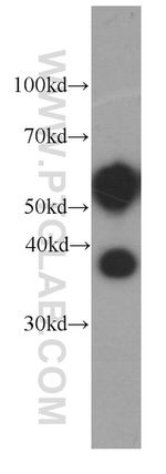 Fetuin-A Antibody in Western Blot (WB)