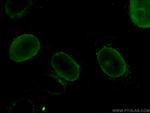 Lamin B1 Antibody in Immunocytochemistry (ICC/IF)