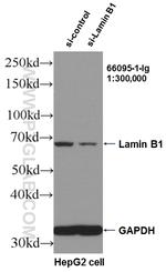 Lamin B1 Antibody in Western Blot (WB)