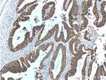 Villin Antibody in Immunohistochemistry (Paraffin) (IHC (P))