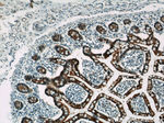 Villin Antibody in Immunohistochemistry (Paraffin) (IHC (P))