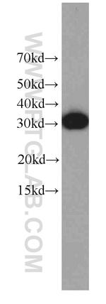 EXOSC2 Antibody in Western Blot (WB)