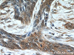 EXOSC2 Antibody in Immunohistochemistry (Paraffin) (IHC (P))