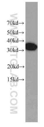 EXOSC2 Antibody in Western Blot (WB)