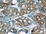 PDCD4 Antibody in Immunohistochemistry (Paraffin) (IHC (P))