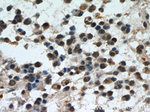 PDCD4 Antibody in Immunohistochemistry (Paraffin) (IHC (P))