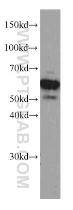 PDCD4 Antibody in Western Blot (WB)