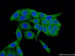 P4HA1 Antibody in Immunocytochemistry (ICC/IF)