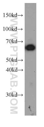 P4HA1 Antibody in Western Blot (WB)