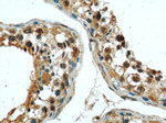 P4HA1 Antibody in Immunohistochemistry (Paraffin) (IHC (P))