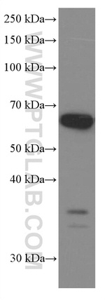 P4HA1 Antibody in Western Blot (WB)