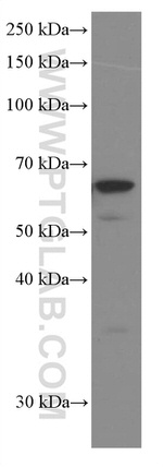 P4HA1 Antibody in Western Blot (WB)