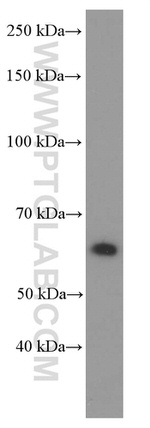 P4HA1 Antibody in Western Blot (WB)