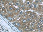 RBP4 Antibody in Immunohistochemistry (Paraffin) (IHC (P))