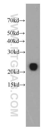 RBP4 Antibody in Western Blot (WB)