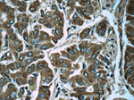 PGM1 Antibody in Immunohistochemistry (Paraffin) (IHC (P))