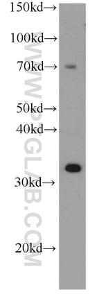 SULT4A1 Antibody in Western Blot (WB)