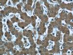 Prealbumin/transthyretin Antibody in Immunohistochemistry (Paraffin) (IHC (P))