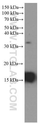 Prealbumin/transthyretin Antibody in Western Blot (WB)