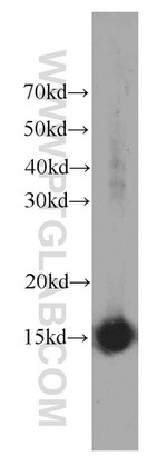 SNRPD2 Antibody in Western Blot (WB)