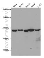 TFIP11 Antibody in Western Blot (WB)