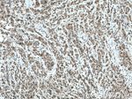 TFIP11 Antibody in Immunohistochemistry (Paraffin) (IHC (P))