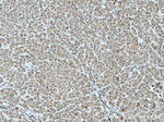 TFIP11 Antibody in Immunohistochemistry (Paraffin) (IHC (P))