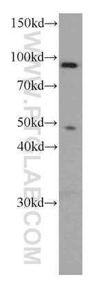 TFIP11 Antibody in Western Blot (WB)