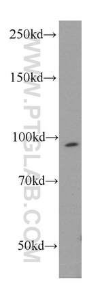 TFIP11 Antibody in Western Blot (WB)