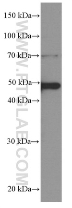 CSK Antibody in Western Blot (WB)