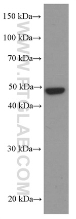 CSK Antibody in Western Blot (WB)