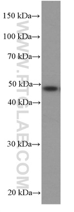 CSK Antibody in Western Blot (WB)