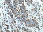 ECHS1 Antibody in Immunohistochemistry (Paraffin) (IHC (P))