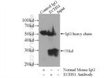 ECHS1 Antibody in Immunoprecipitation (IP)