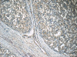 ECHS1 Antibody in Immunohistochemistry (Paraffin) (IHC (P))