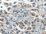 FUT8 Antibody in Immunohistochemistry (Paraffin) (IHC (P))