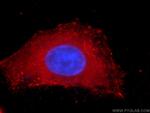 PDH E1 alpha Antibody in Immunocytochemistry (ICC/IF)