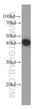 PDH E1 alpha Antibody in Western Blot (WB)