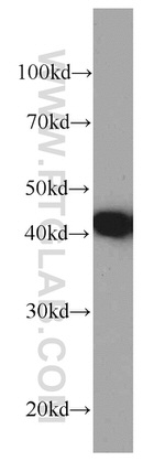 PDH E1 alpha Antibody in Western Blot (WB)