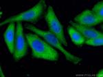 Aldolase C Antibody in Immunocytochemistry (ICC/IF)