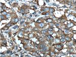 Aldolase C Antibody in Immunohistochemistry (Paraffin) (IHC (P))