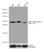 Alpha galactosidase A Antibody in Western Blot (WB)