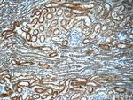 Alpha galactosidase A Antibody in Immunohistochemistry (Paraffin) (IHC (P))