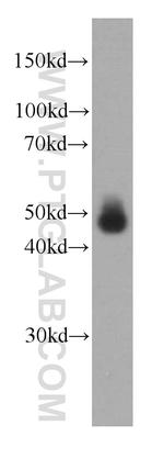 Alpha galactosidase A Antibody in Western Blot (WB)