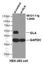 Alpha galactosidase A Antibody in Western Blot (WB)