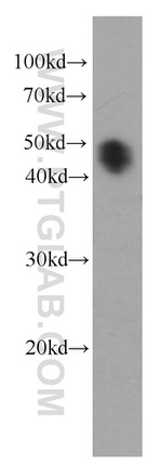 Alpha galactosidase A Antibody in Western Blot (WB)