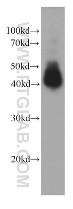 Alpha galactosidase A Antibody in Western Blot (WB)