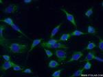 Rac1 Antibody in Immunocytochemistry (ICC/IF)