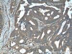 Rac1 Antibody in Immunohistochemistry (Paraffin) (IHC (P))