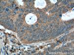 Rac1 Antibody in Immunohistochemistry (Paraffin) (IHC (P))